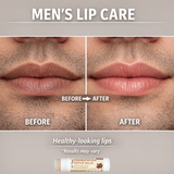 Skin Centives Pigmentation Repair Balm with 1% Kojic Acid, Licorice & SPF 30