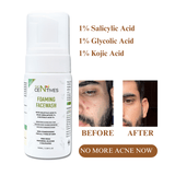 Skin Centives Face Wash for Oily Skin – 1% Salicylic Acid , 1% Glycolic Acid & 1% Kojic Acid – 100ML