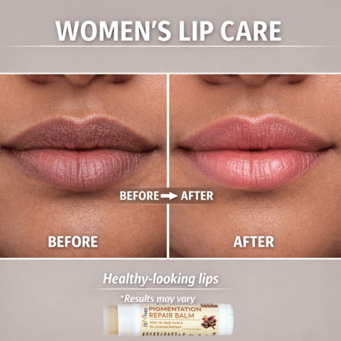 Skin Centives Pigmentation Repair Balm with 1% Kojic Acid, Licorice & SPF 30