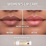 Skin Centives Pigmentation Repair Balm with 1% Kojic Acid, Licorice & SPF 30